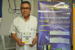 stem cell