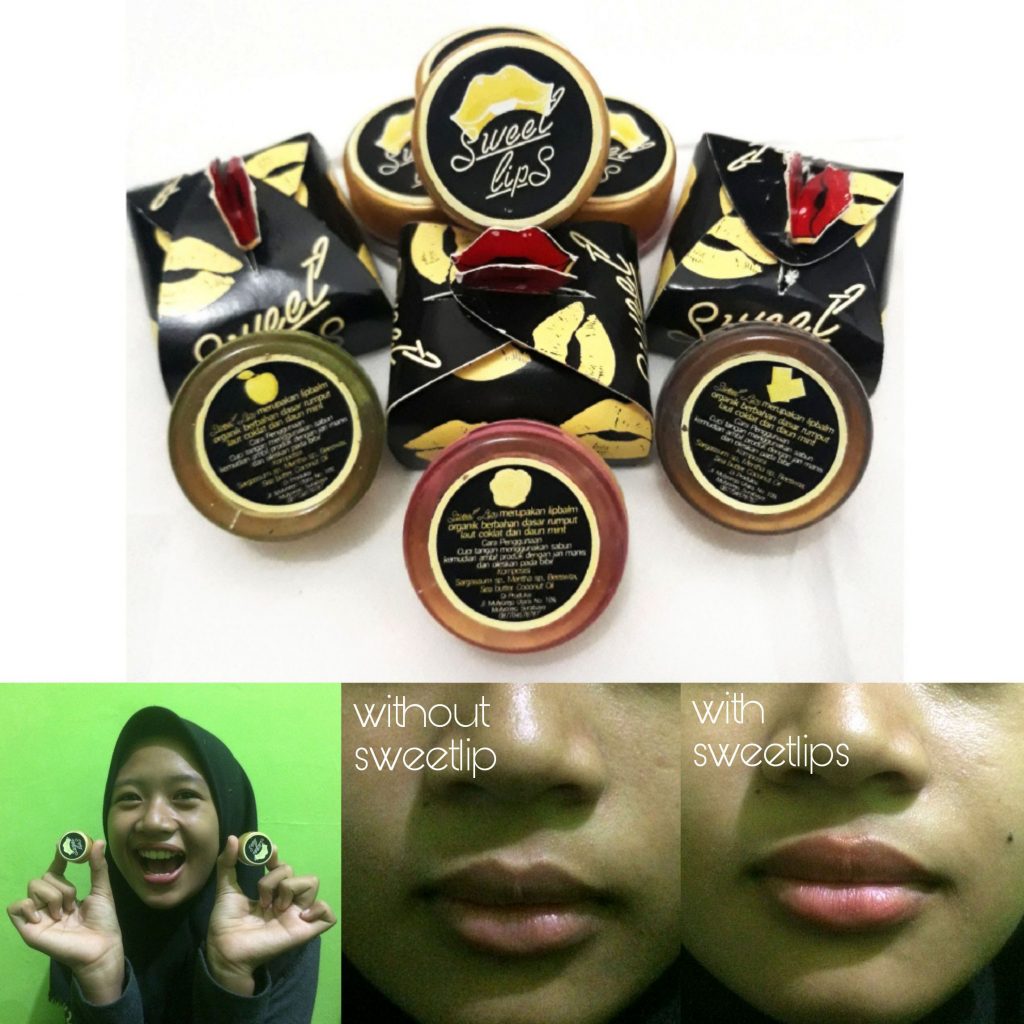 bibir pecah-pecah