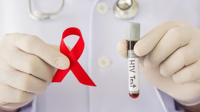 Manifestasi Patognomonik Penyakit Periodontal pada Penderita HIV/AIDS
