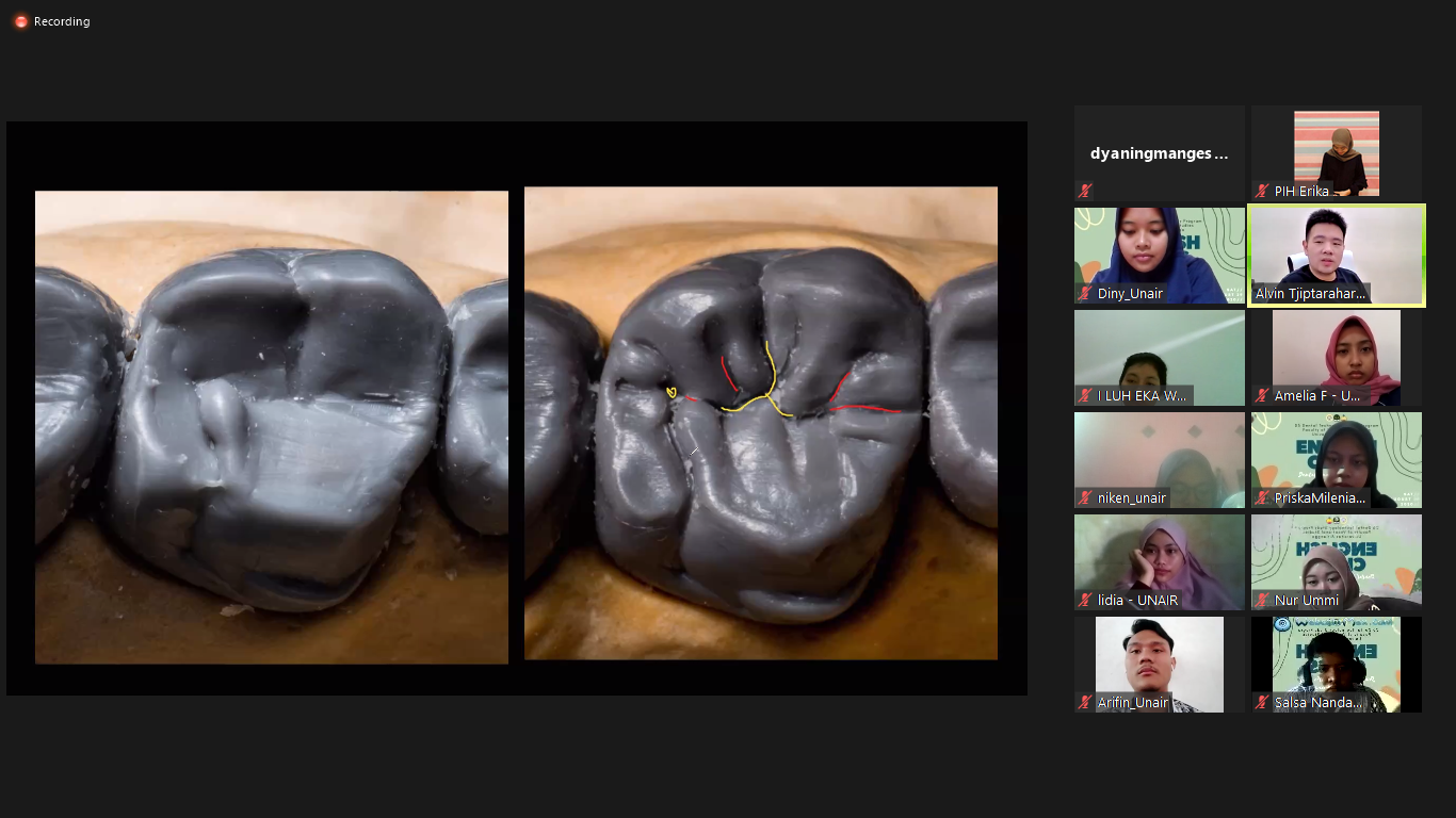 PELAKSANAAN kegiatan webinar Prodi D3 Teknik Kesehatan Gigi Fakultas Vokasi Universitas Airlangga pada Sabtu (29/08/2020). (Foto: istimewa)