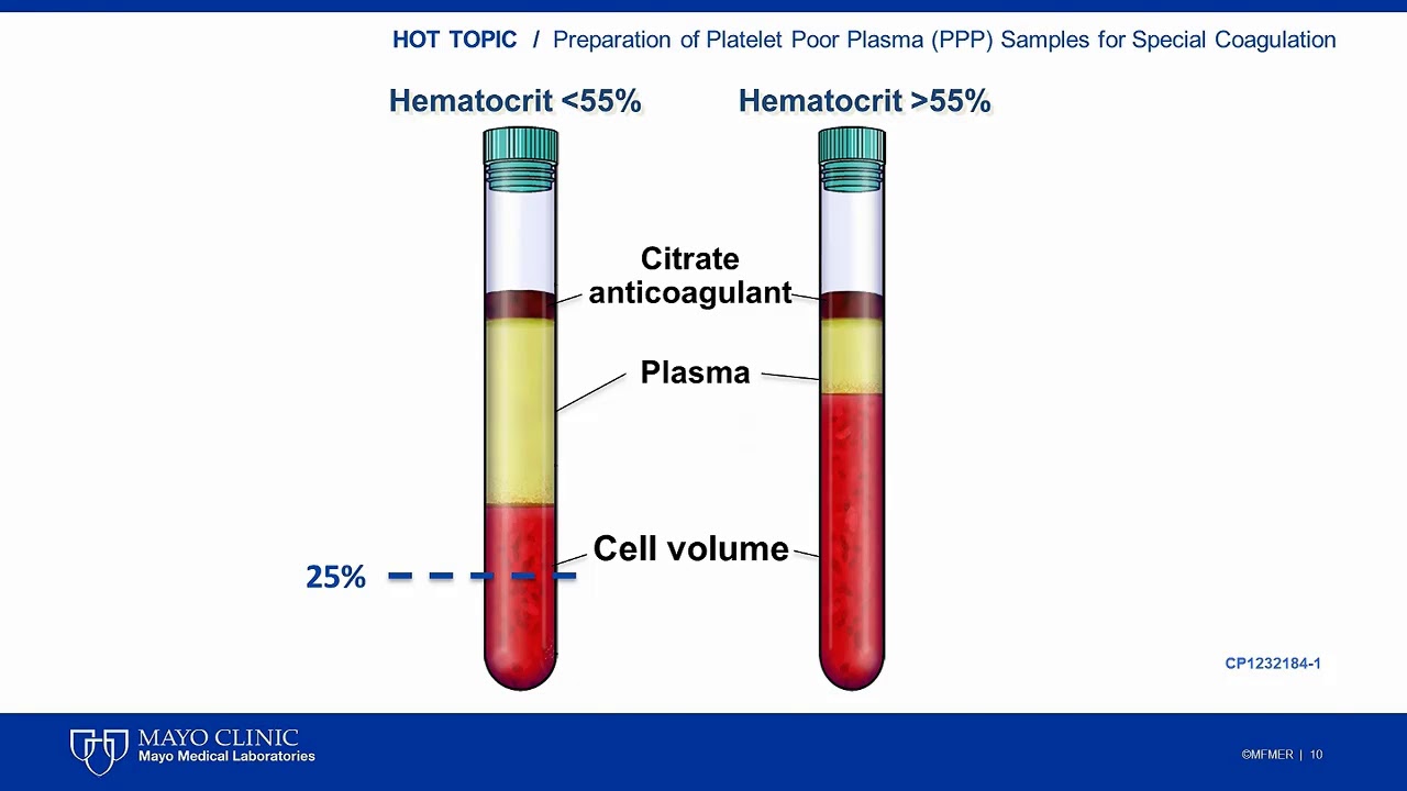 Menilik Perbedaan Jumlah Platelet pada Platelet Poor Plasma (PPP) yang Dihasilkan pada Berbagai Teknik Sentrifugasi
