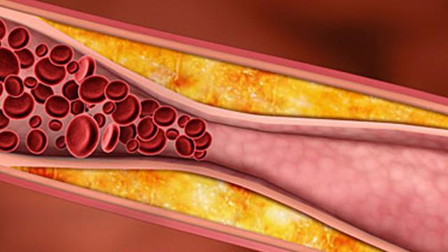 Pengaruh Ekstrak Etanol Daun Kersen pada Kadar Kolesterol