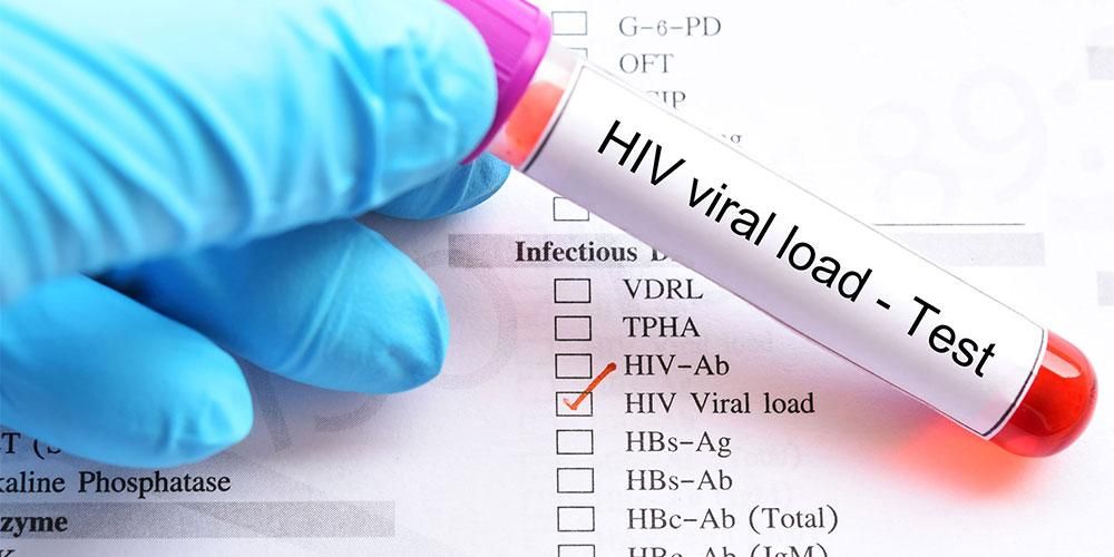 Illustration: HIV viral load. (Photo: SehatQ)