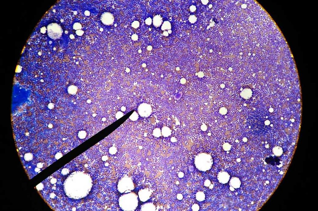ILUSTRASI Komponen Stromal Vascular Fraction (SVF). (Foto: Istimewa)