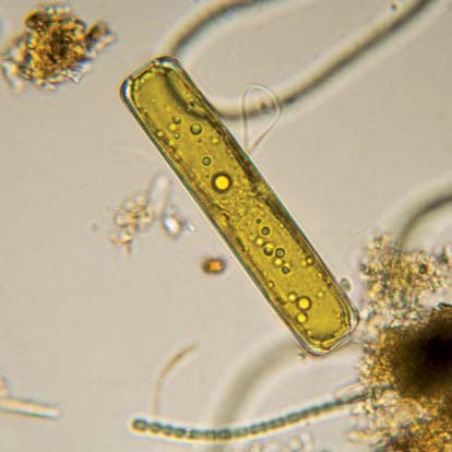 ILLUSTRATION OF Diatom Phytoplankton. (Source: diatoms.org)