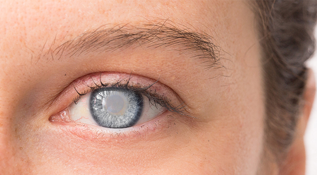 Ilustrasi oleh Halodoc