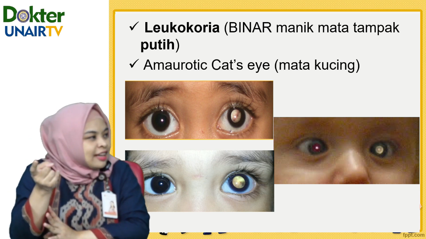 Dosen Fk Paparkan Retinoblastoma Dalam Unair Tv Universitas Airlangga Official Website