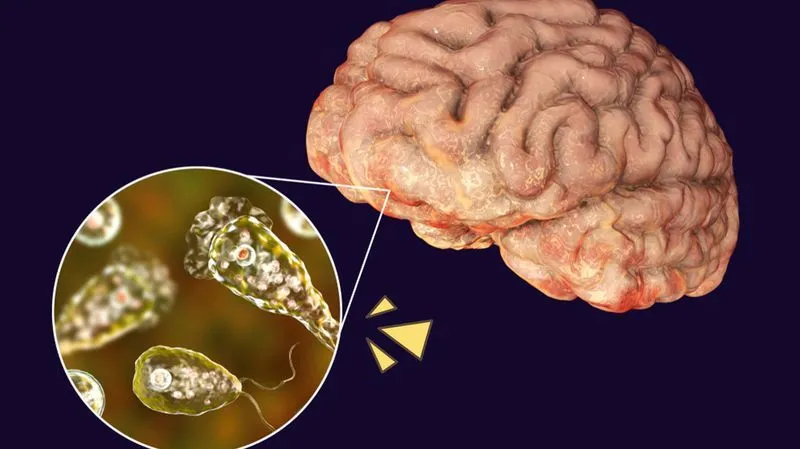 UNAIR Parasitology expert: Stay alerted on rare case of brain-eating amoeba