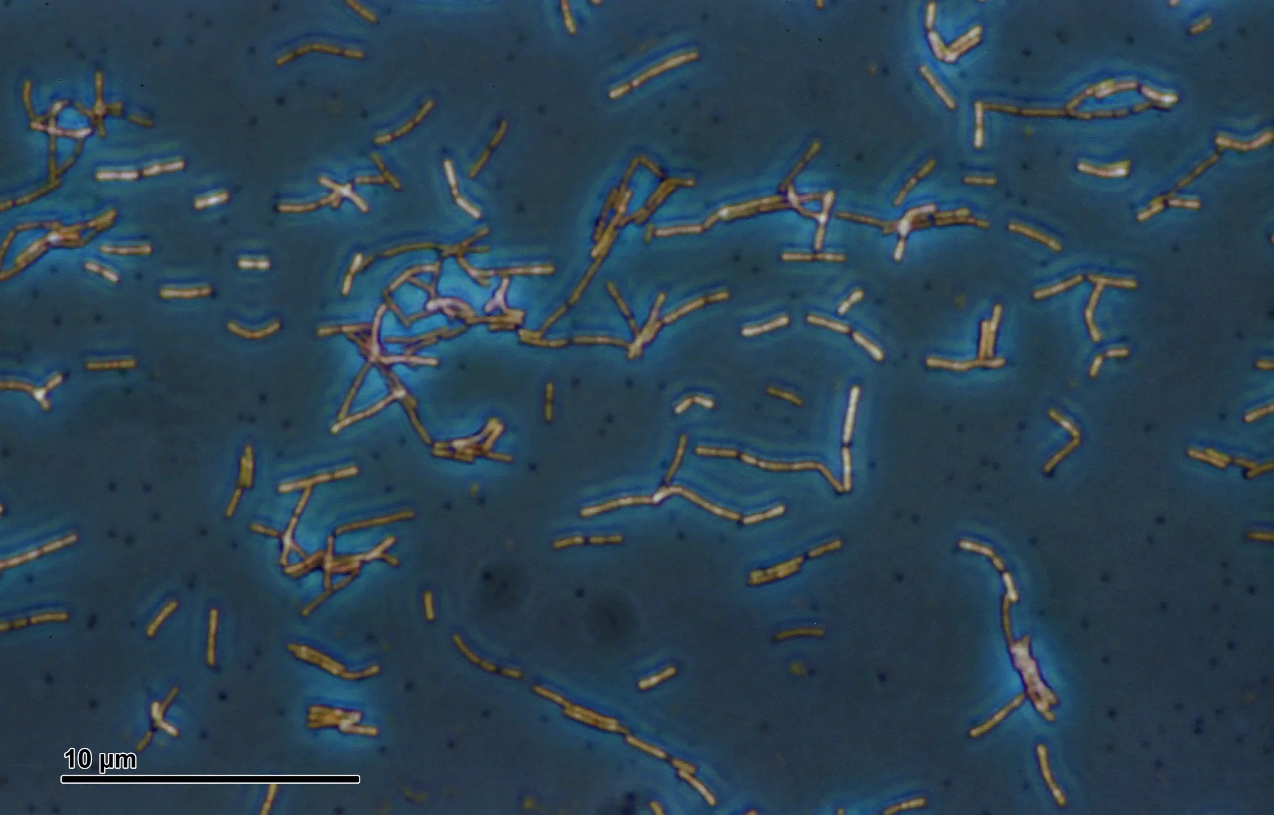 Lactobacillus acidophilus (Foto: commons.wikimedia.org)