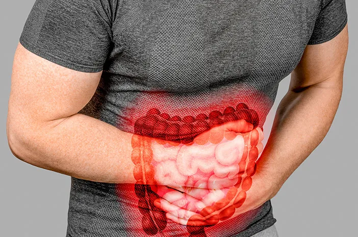 Strategi Negara Berpendapatan Rendah dalam Diagnosis Sindroma Iritasi Usus