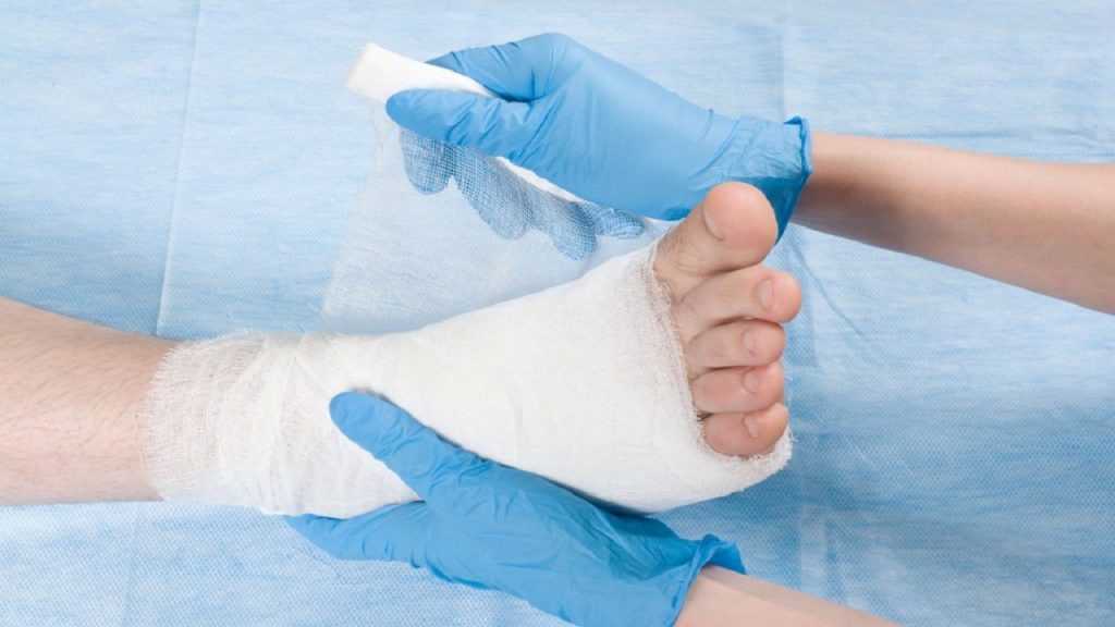 Peran Makrofag M1 dan M2 dalam Penyembuhan Luka pada Pasien Diabetes