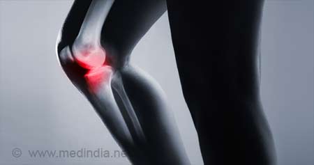 Ilustrasi osteolisis (sumber: medindia.net)